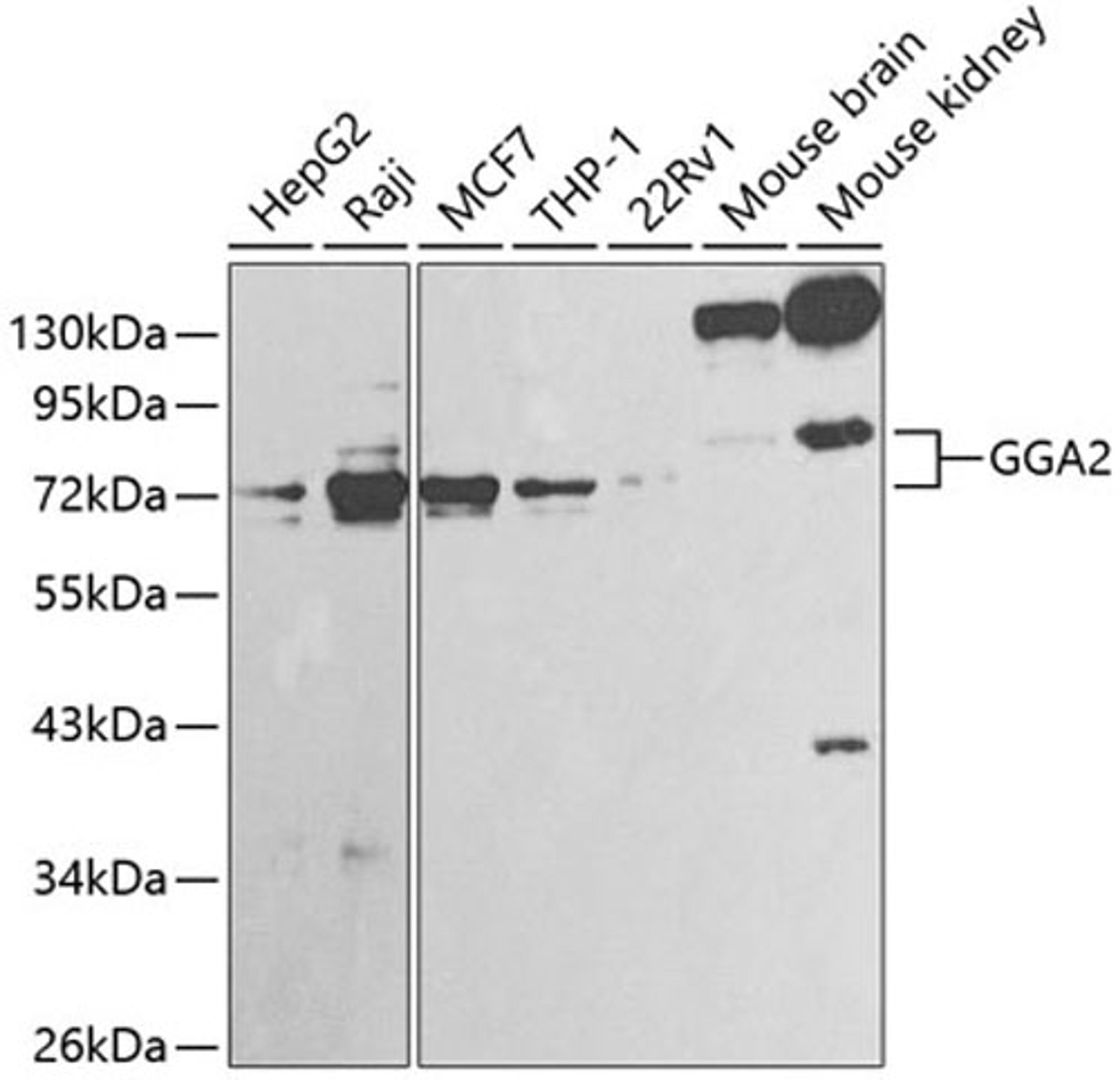 Western blot - GGA2 antibody (A1186)