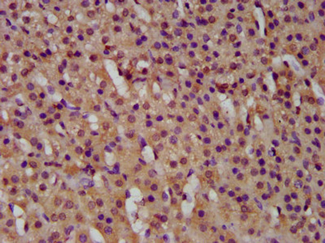 IHC image of CSB-PA010031LA01HU diluted at 1:500 and staining in paraffin-embedded human adrenal gland tissue performed on a Leica BondTM system. After dewaxing and hydration, antigen retrieval was mediated by high pressure in a citrate buffer (pH 6.0). Section was blocked with 10% normal goat serum 30min at RT. Then primary antibody (1% BSA) was incubated at 4&deg;C overnight. The primary is detected by a biotinylated secondary antibody and visualized using an HRP conjugated SP system.