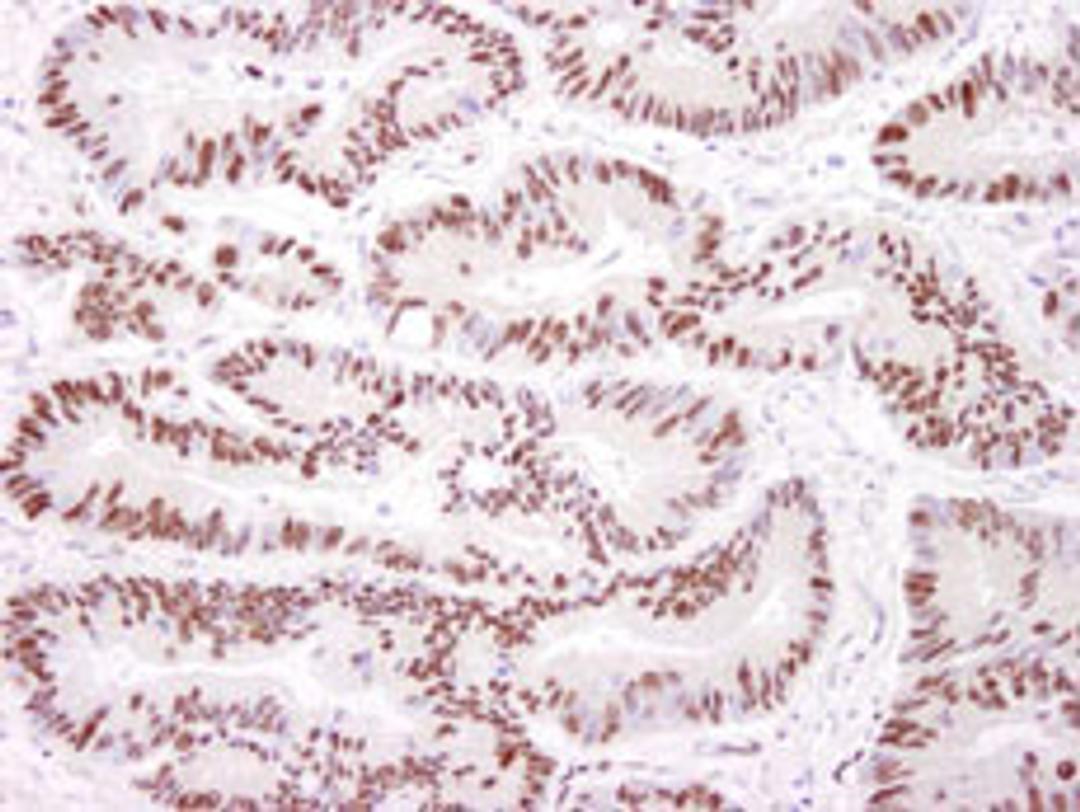 Detection of human DNA-PKcs by immunohistochemistry.