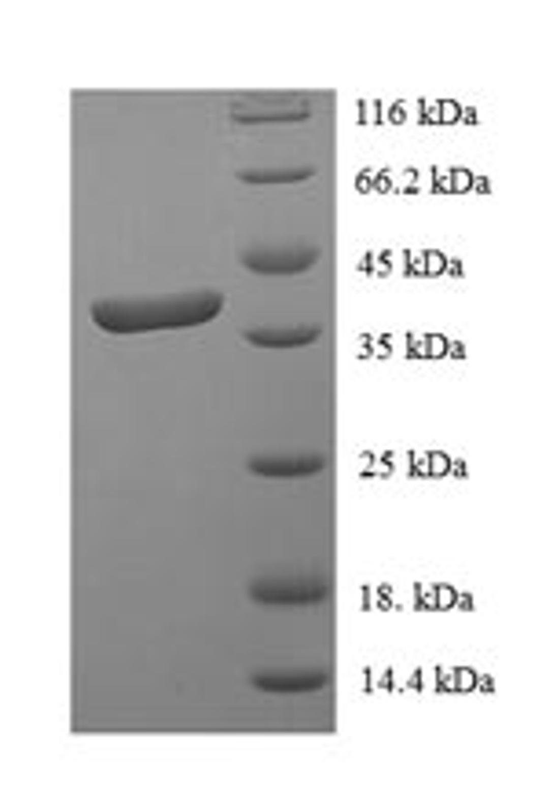 (Tris-Glycine gel) Discontinuous SDS-PAGE (reduced) with 5% enrichment gel and 15% separation gel.