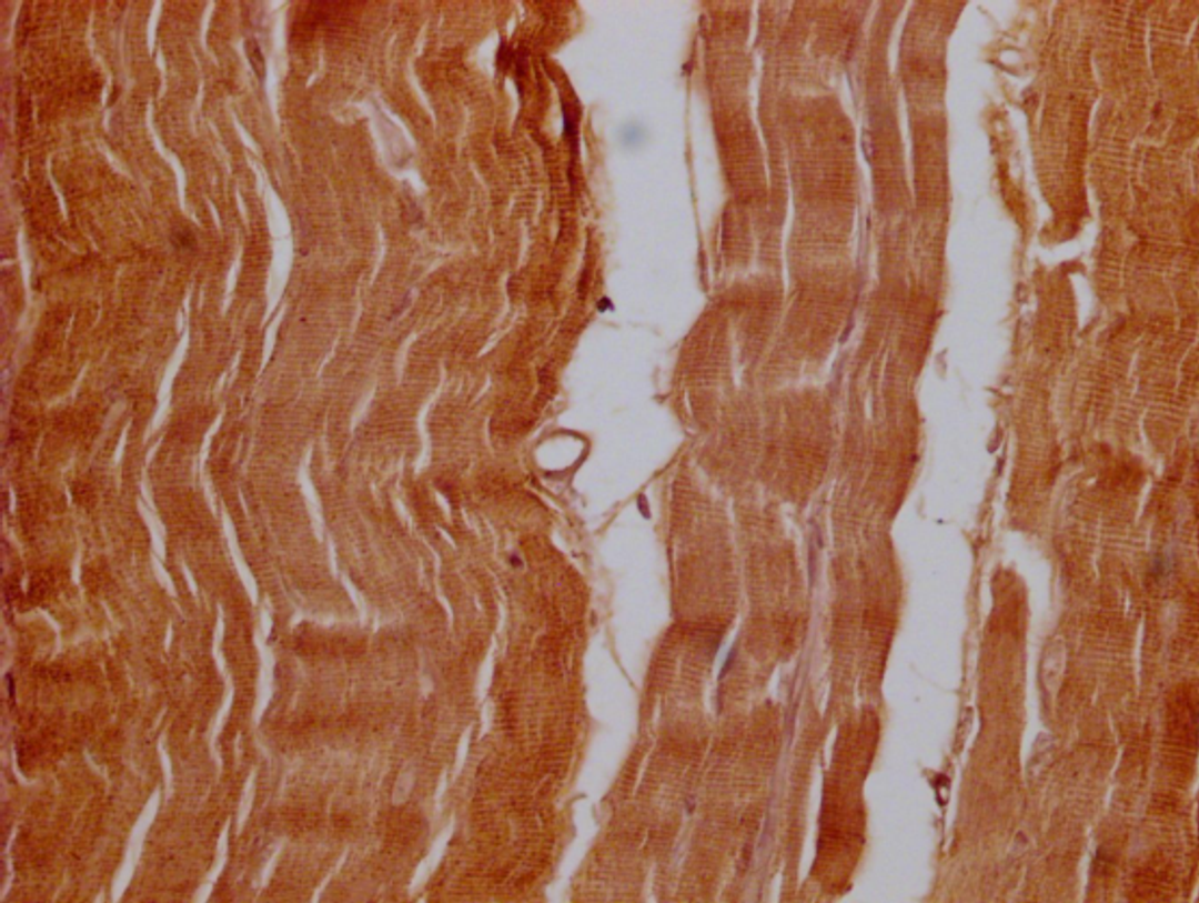IHC image of CSB-PA016289LA01HU diluted at 1:100 and staining in paraffin-embedded human skeletal muscle tissue performed on a Leica BondTM system. After dewaxing and hydration, antigen retrieval was mediated by high pressure in a citrate buffer (pH 6.0). Section was blocked with 10% normal goat serum 30min at 37℃ Then primary antibody (1% BSA) was incubated at 4°C overnight. The primary is detected by a Goat anti-Mouse IgG labeled by HRP and visualized using 0.05% DAB.