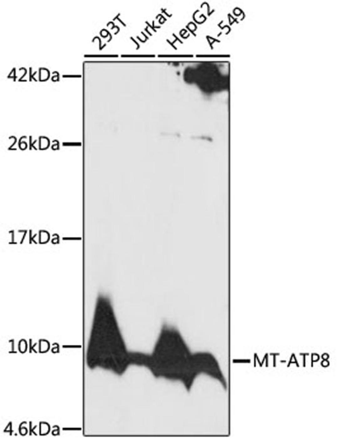 Western blot - MT-ATP8 antibody (A17890)