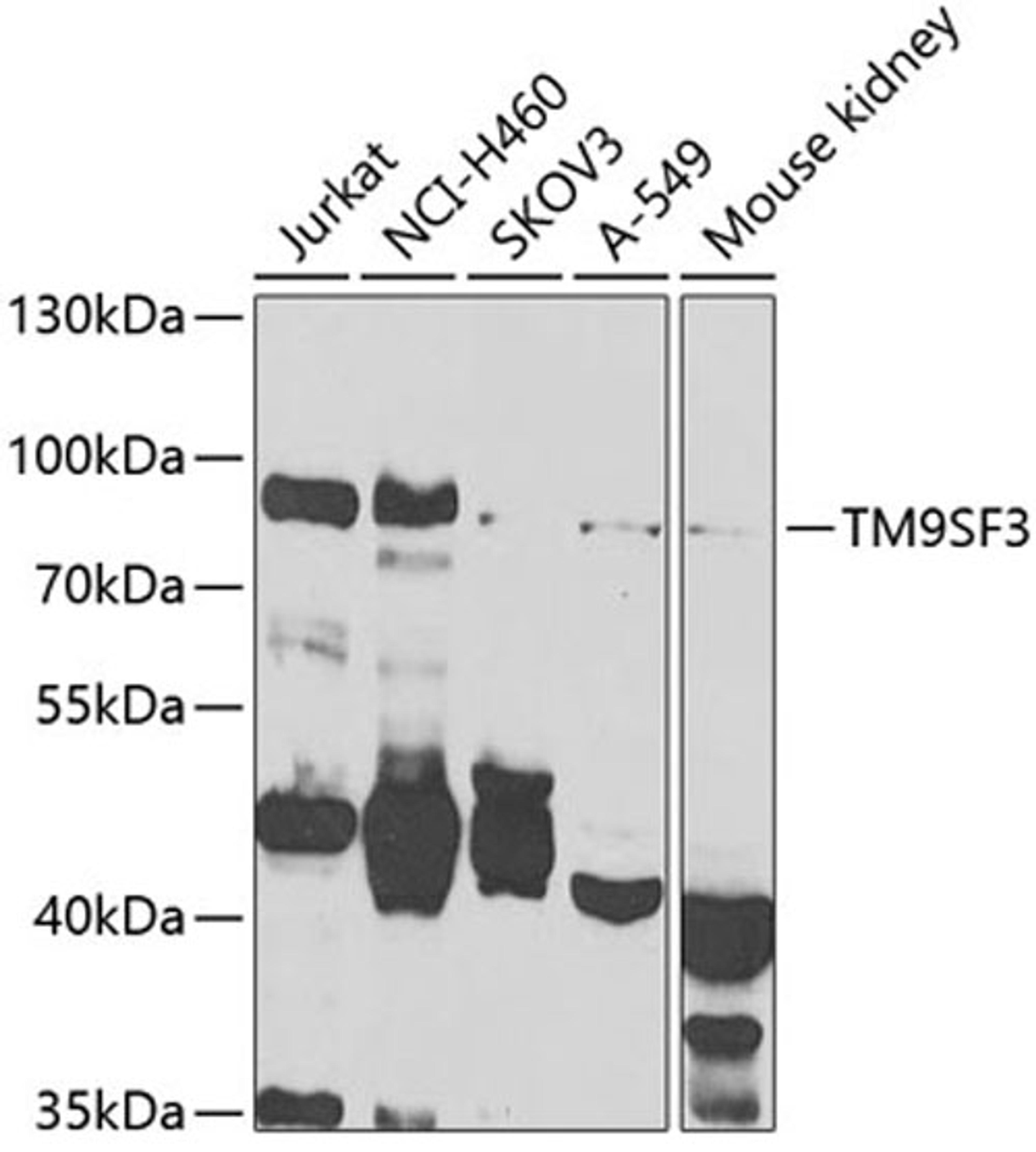 Western blot - TM9SF3 antibody (A7819)