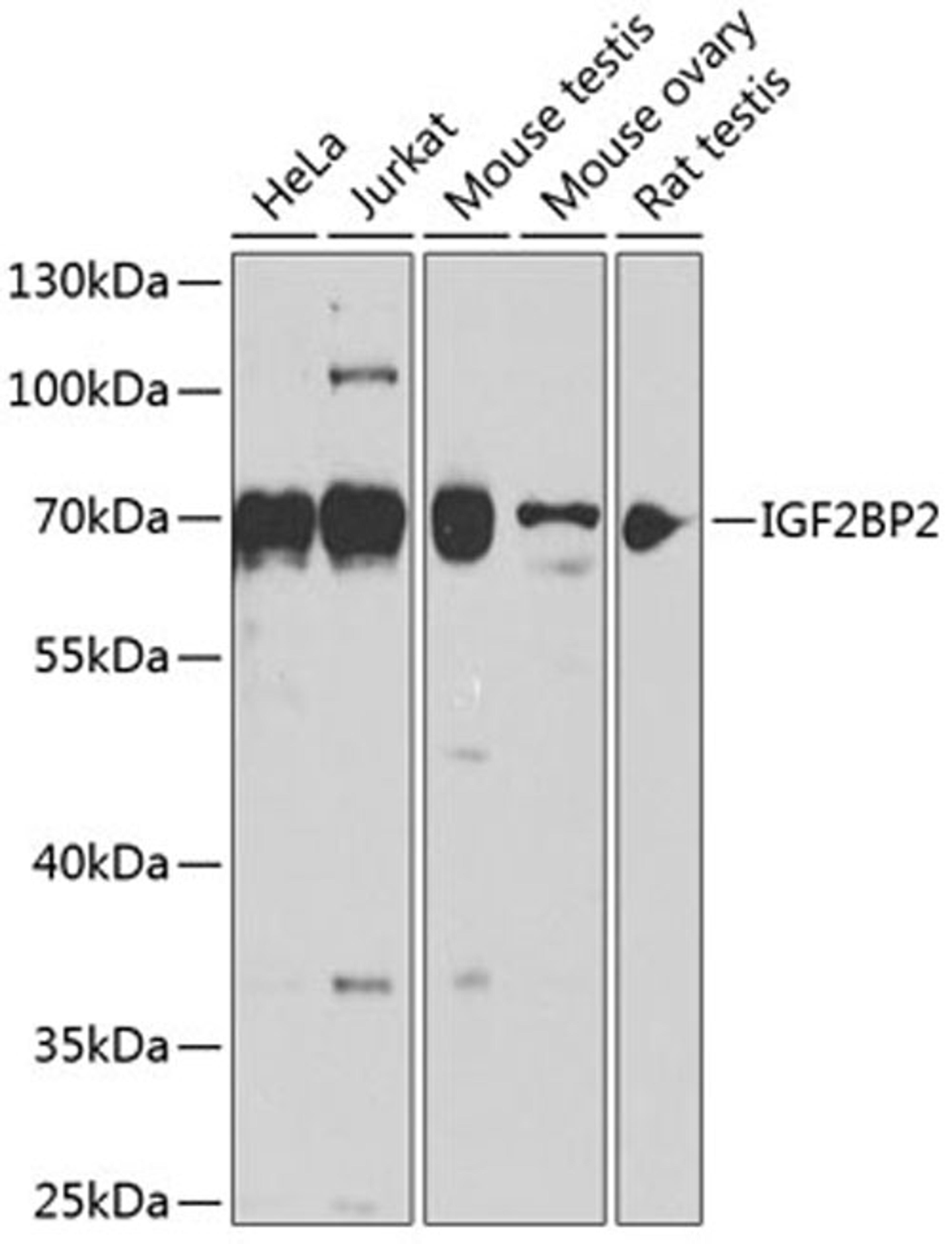 Western blot - IGF2BP2 antibody (A14103)