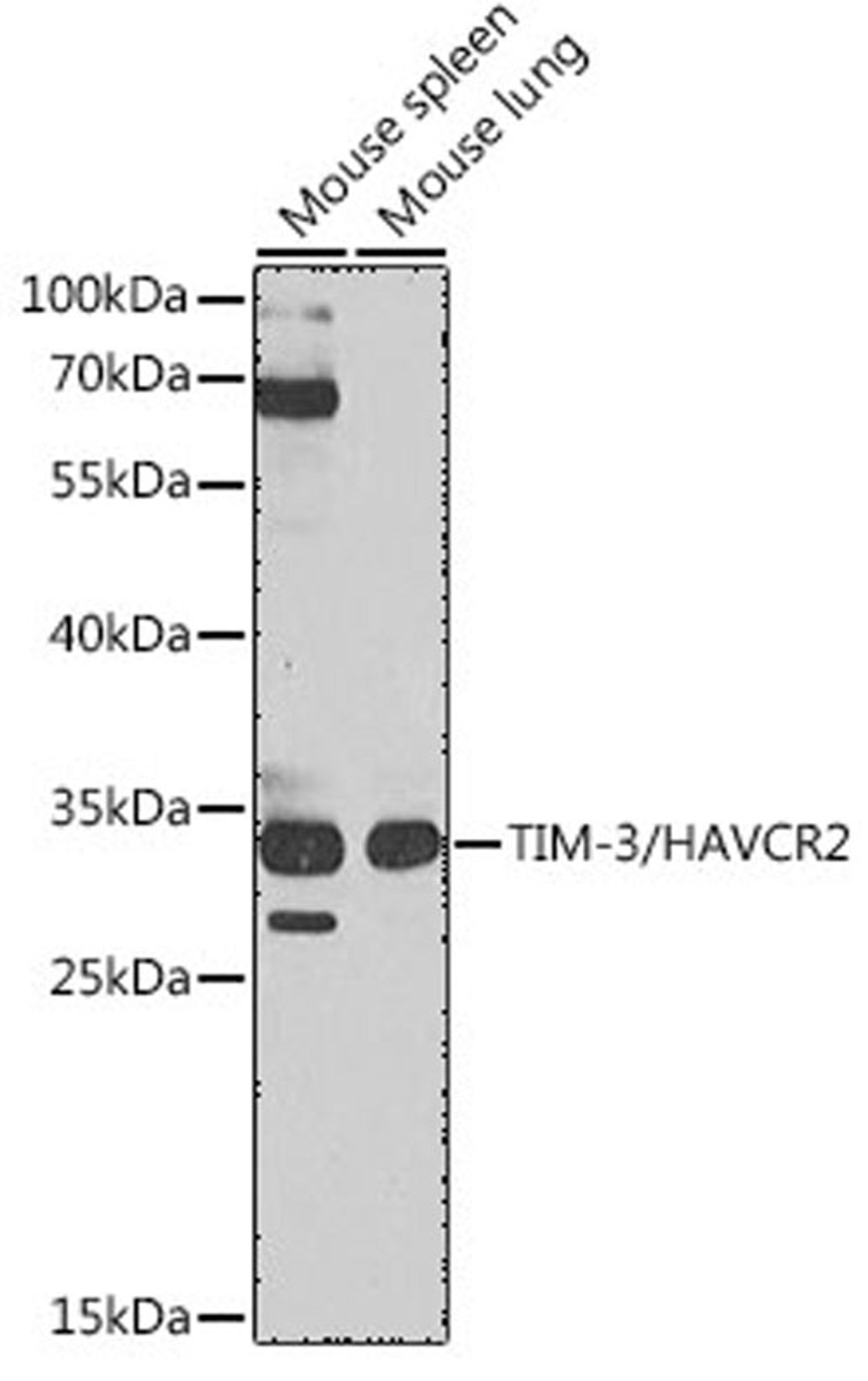 Western blot - TIM-3/HAVCR2 antibody (A13443)