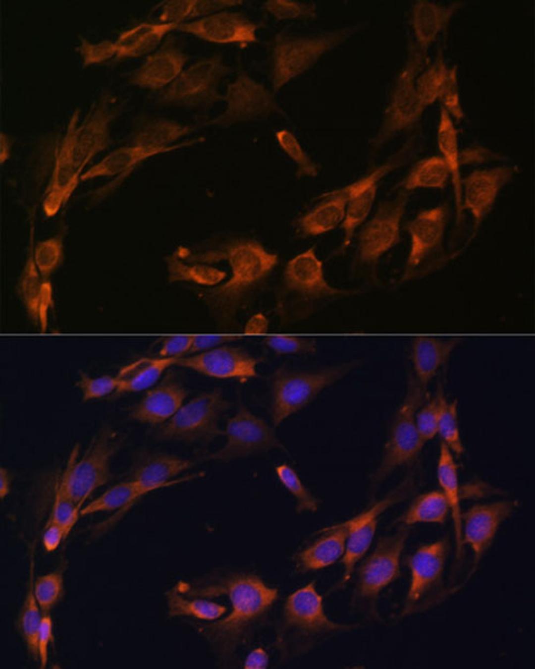 Immunofluorescence - Osteocalcin antibody (A6205)