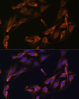 Immunofluorescence - Osteocalcin antibody (A6205)