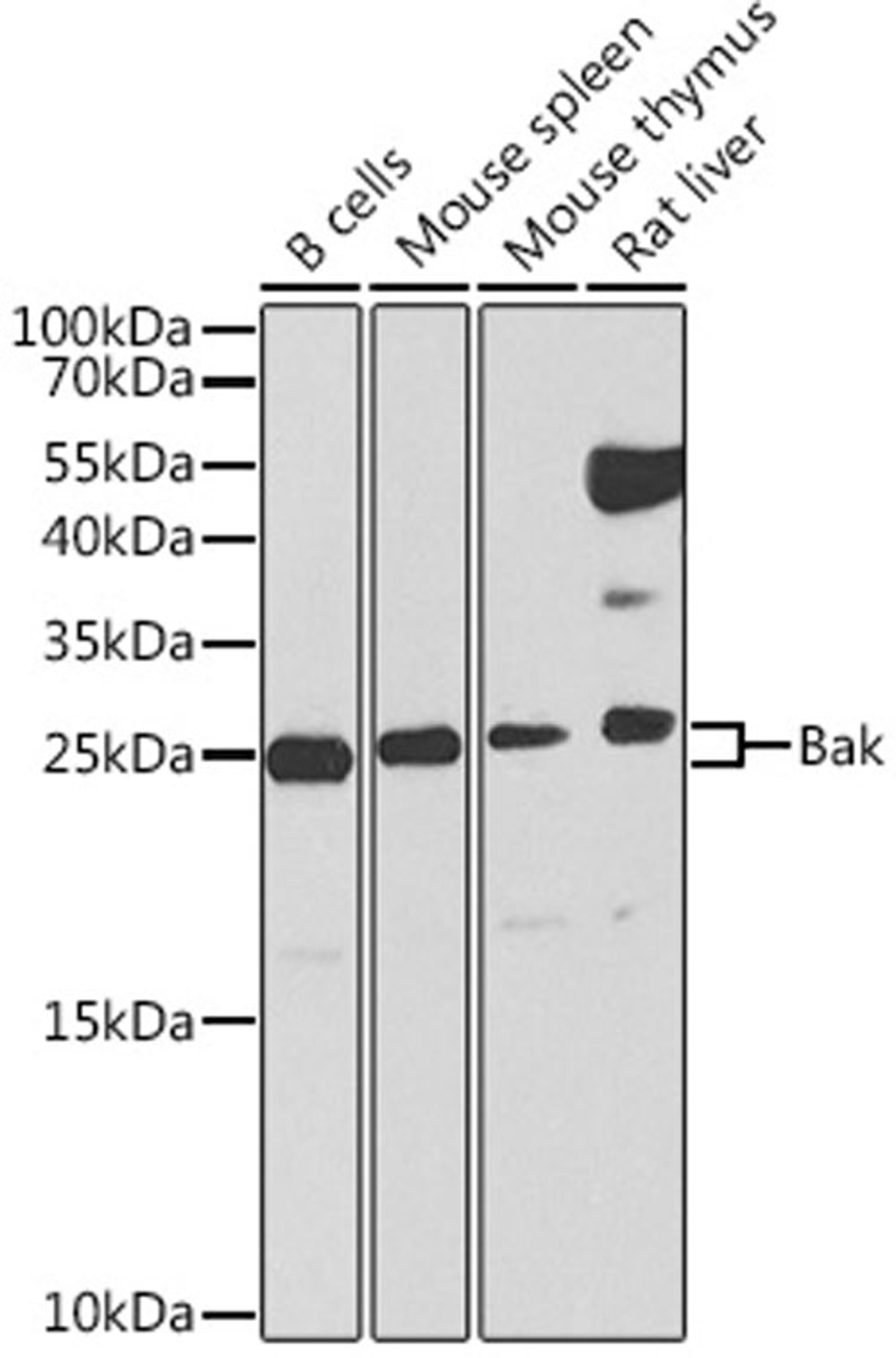 Western blot - Bak Antibody (A0204)