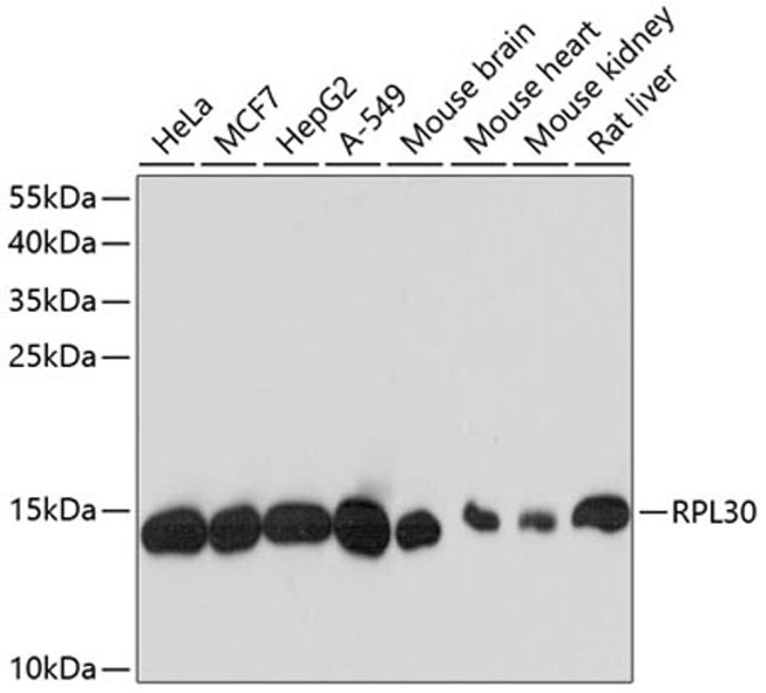 Western blot - RPL30 antibody (A13690)