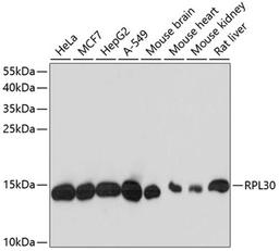 Western blot - RPL30 antibody (A13690)