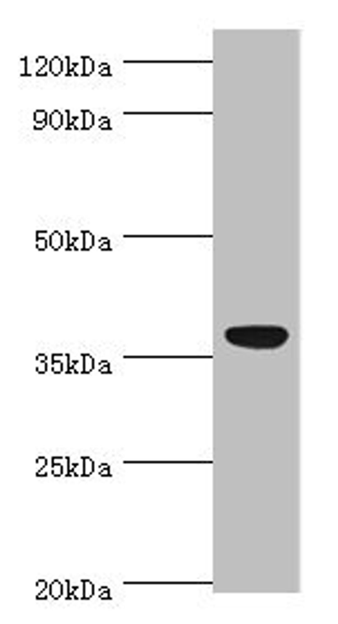 Western blot. All lanes: CD5L antibody at 3ug/ml + A431 whole cell lysate. Secondary. Goat polyclonal to rabbit IgG at 1/10000 dilution. Predicted band size: 38 kDa. Observed band size: 38 kDa. 