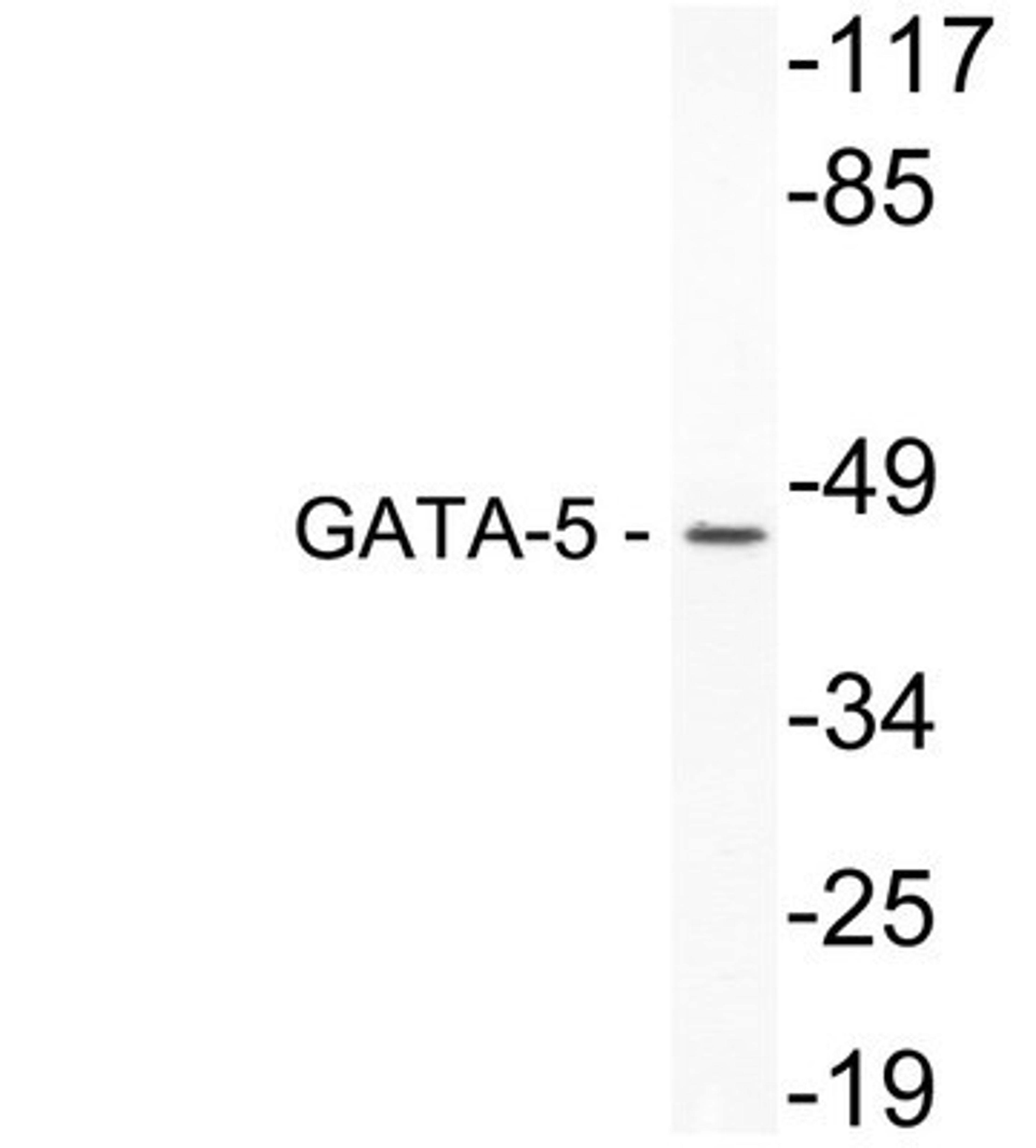 Western Blot: GATA5 Antibody [NBP1-51215] - In extracts from 3T3 cells.