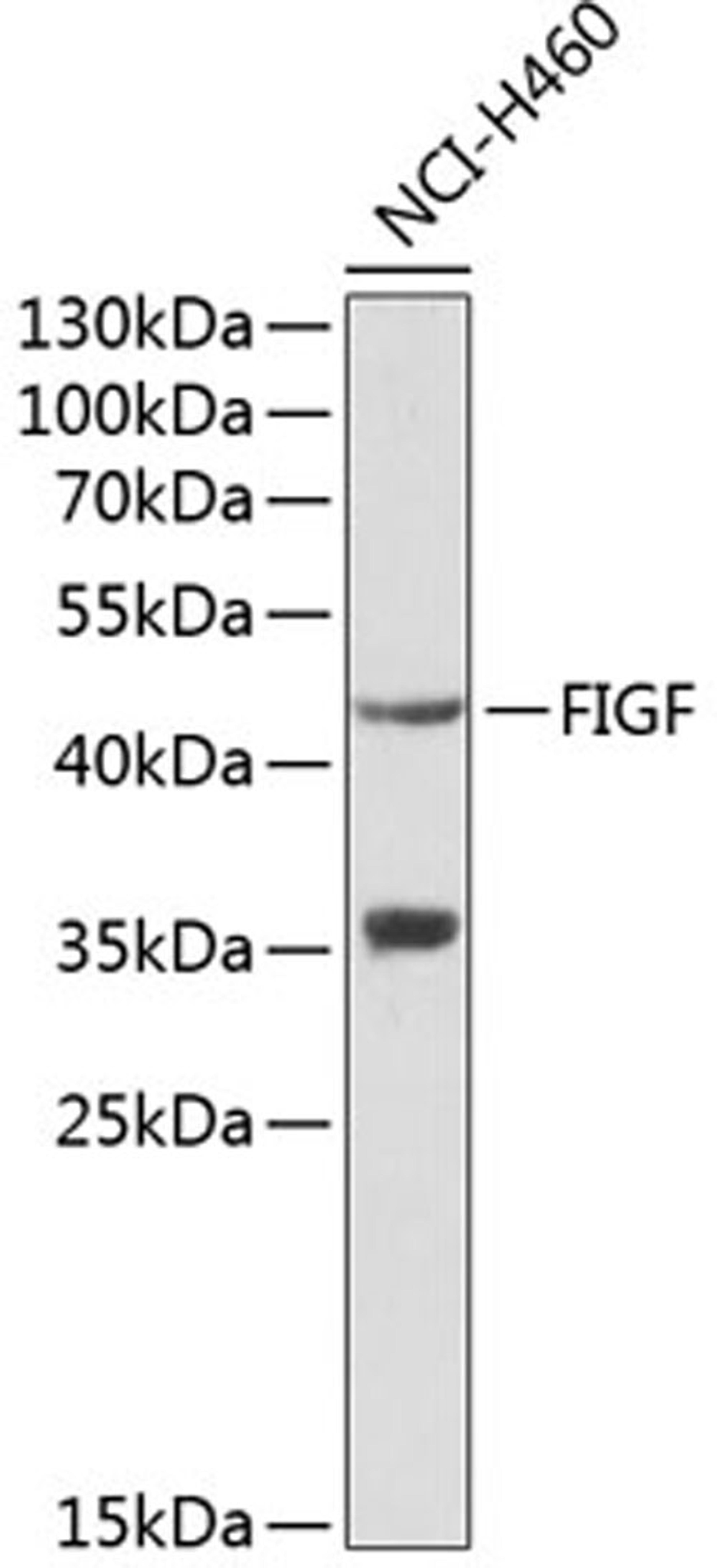 Western blot - VEGFD antibody (A1194)