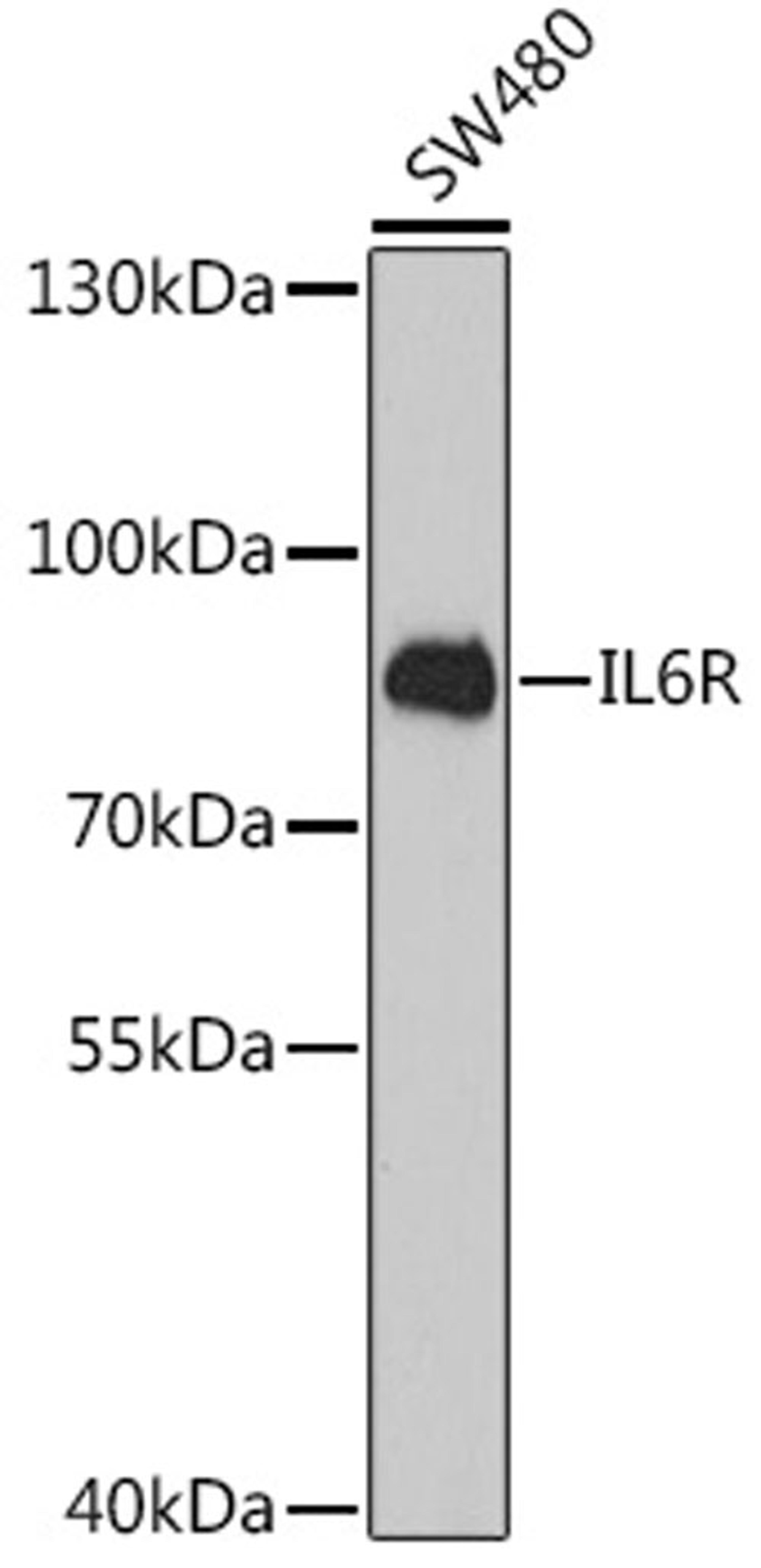 Western blot - IL6R antibody (A1570)