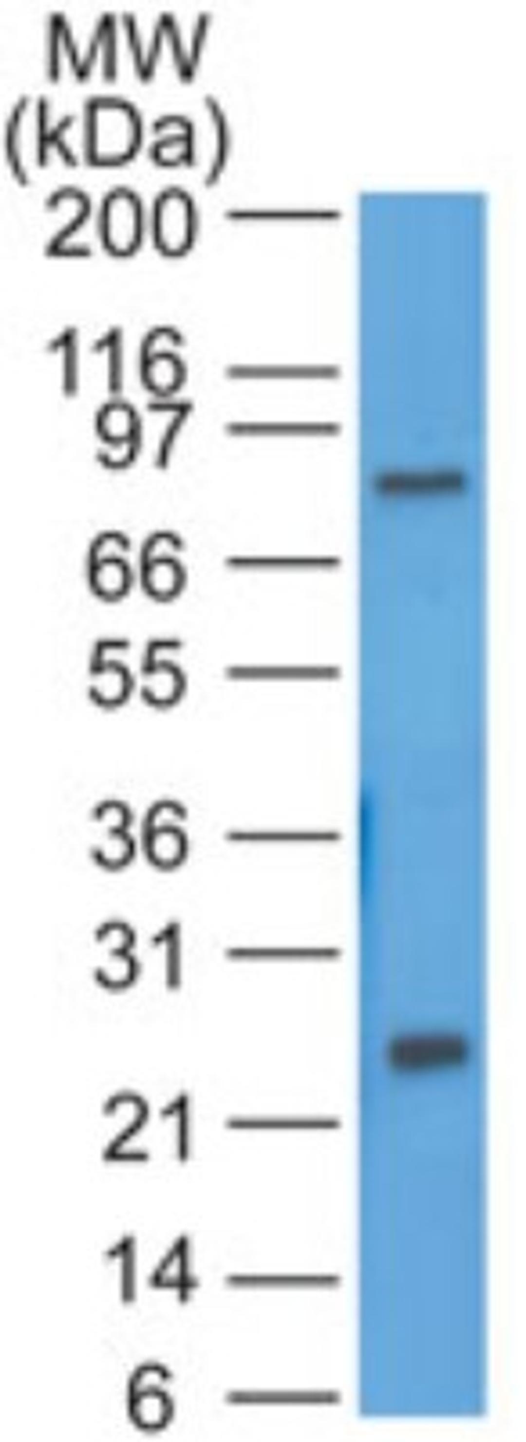 Western Blot: HE4 Antibody [NBP2-27299] - Ovarian tumor line SKOV3 probed with HE4 antibody at 1 ug/ml.