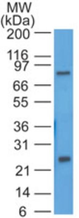 Western Blot: HE4 Antibody [NBP2-27299] - Ovarian tumor line SKOV3 probed with HE4 antibody at 1 ug/ml.