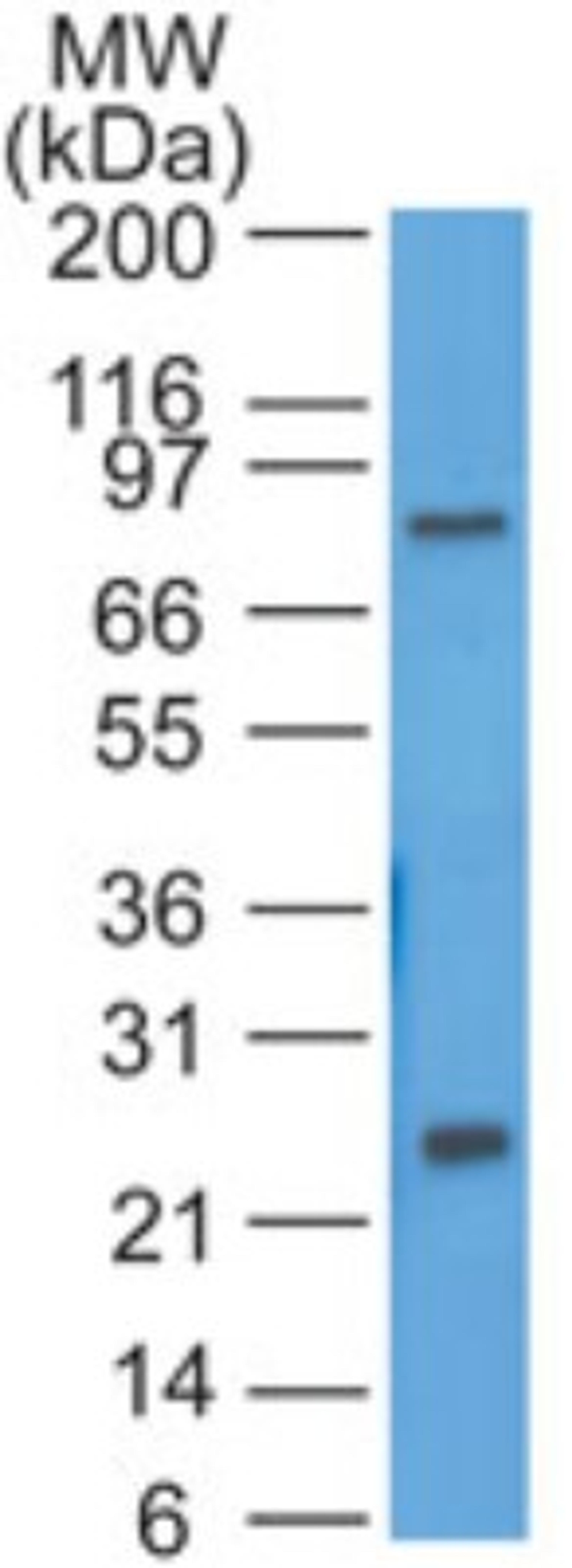 Western Blot: HE4 Antibody [NBP2-27299] - Ovarian tumor line SKOV3 probed with HE4 antibody at 1 ug/ml.