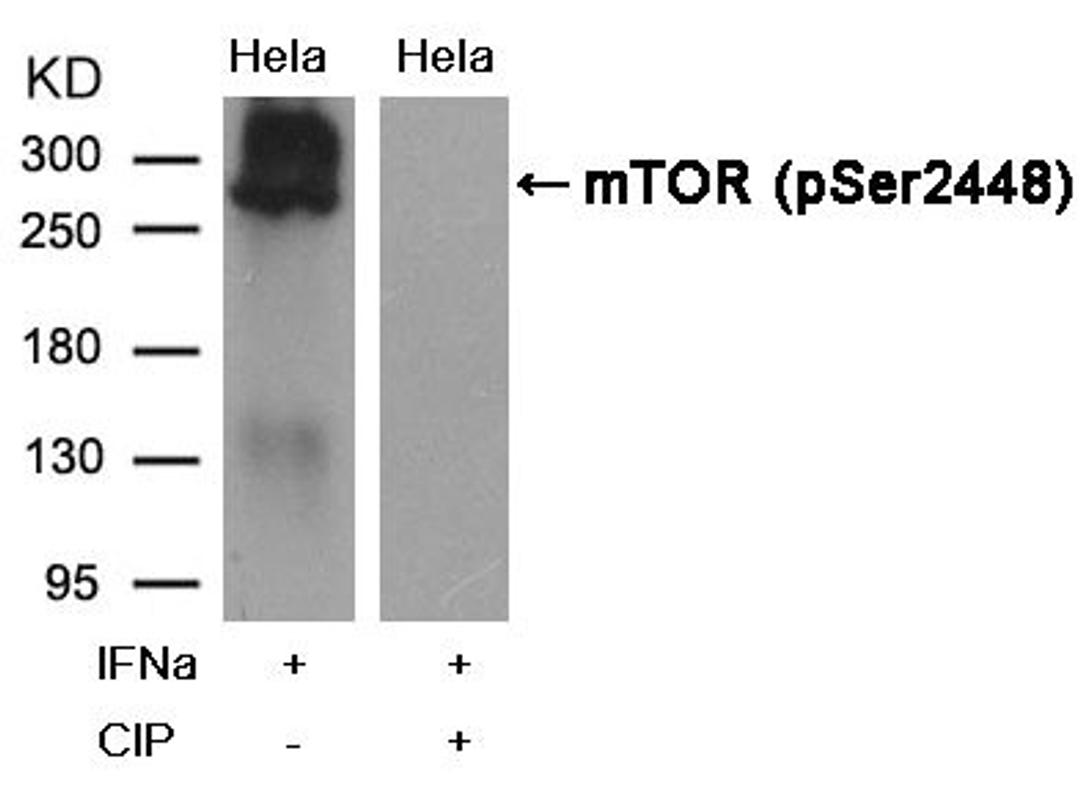 Western blot analysis of extracts from Hela cells, treatedwith IFNa or calf intestinal phosphatase (CIP), using mTOR(Phospho-Ser2448) Antibody.