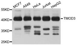 Western blot analysis of extract of various cells using TMOD3 antibody