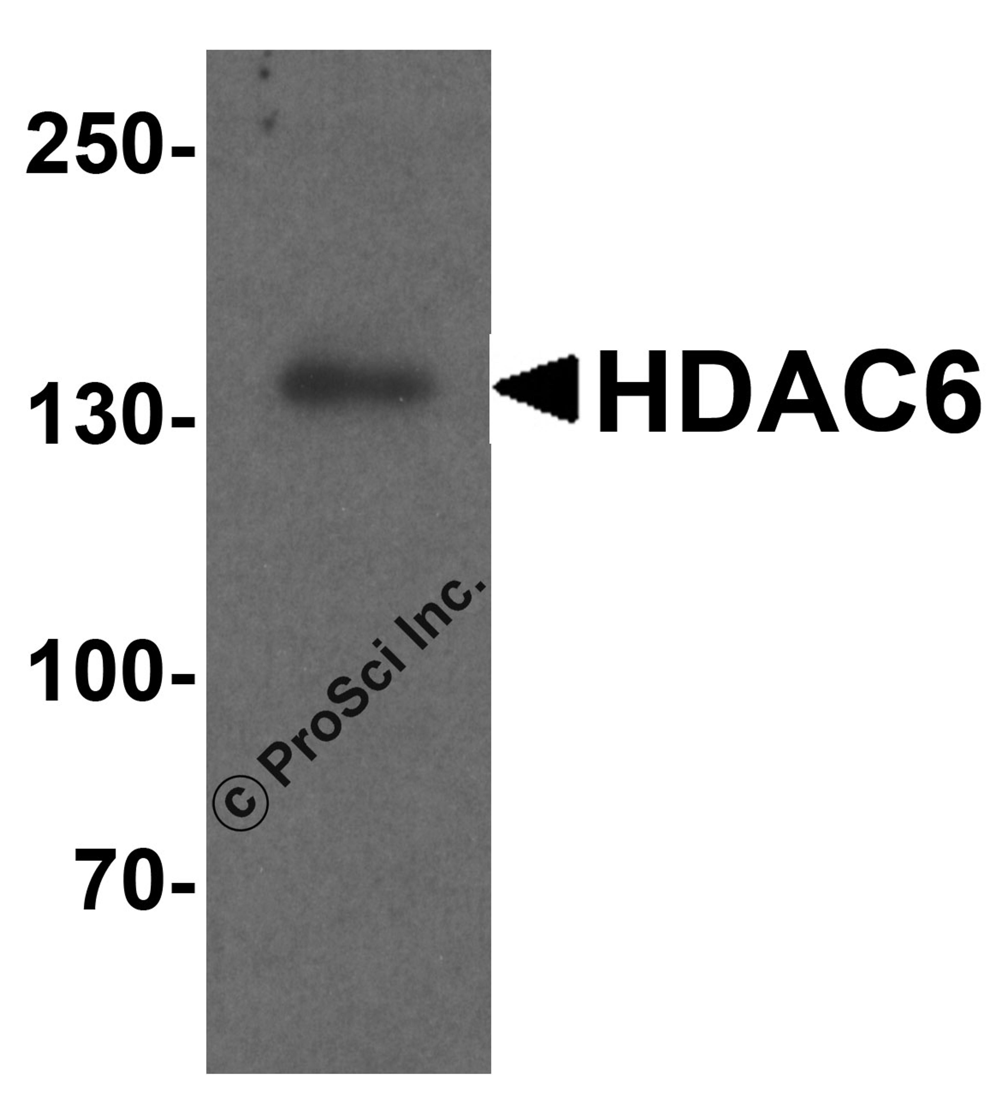 Western blot analysis of HDAC6 in human testis tissue lysate with HDAC6 antibody at 1 μg/ml.