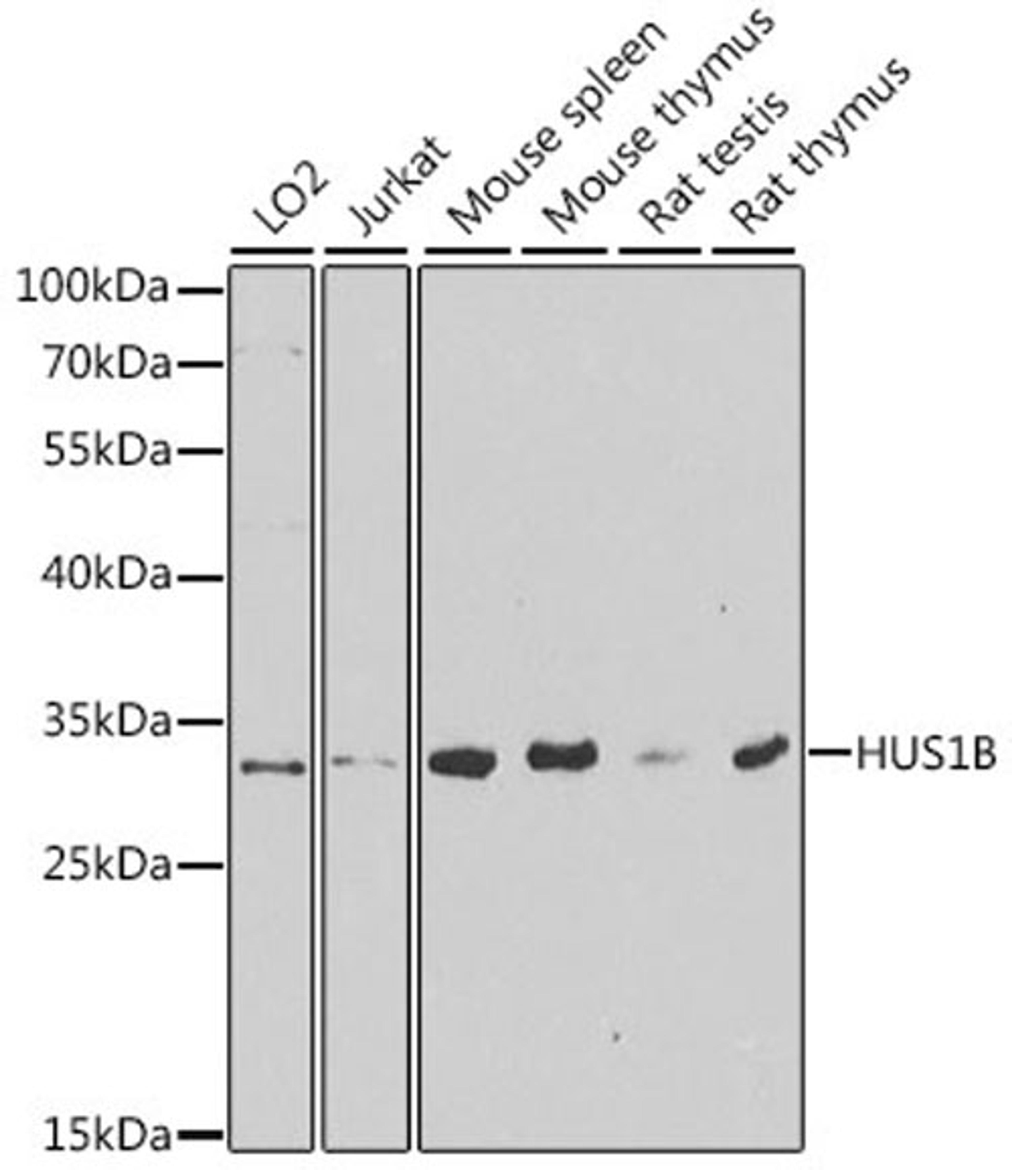 Western blot - HUS1B antibody (A6817)