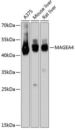 Western blot - MAGEA4 antibody (A11607)