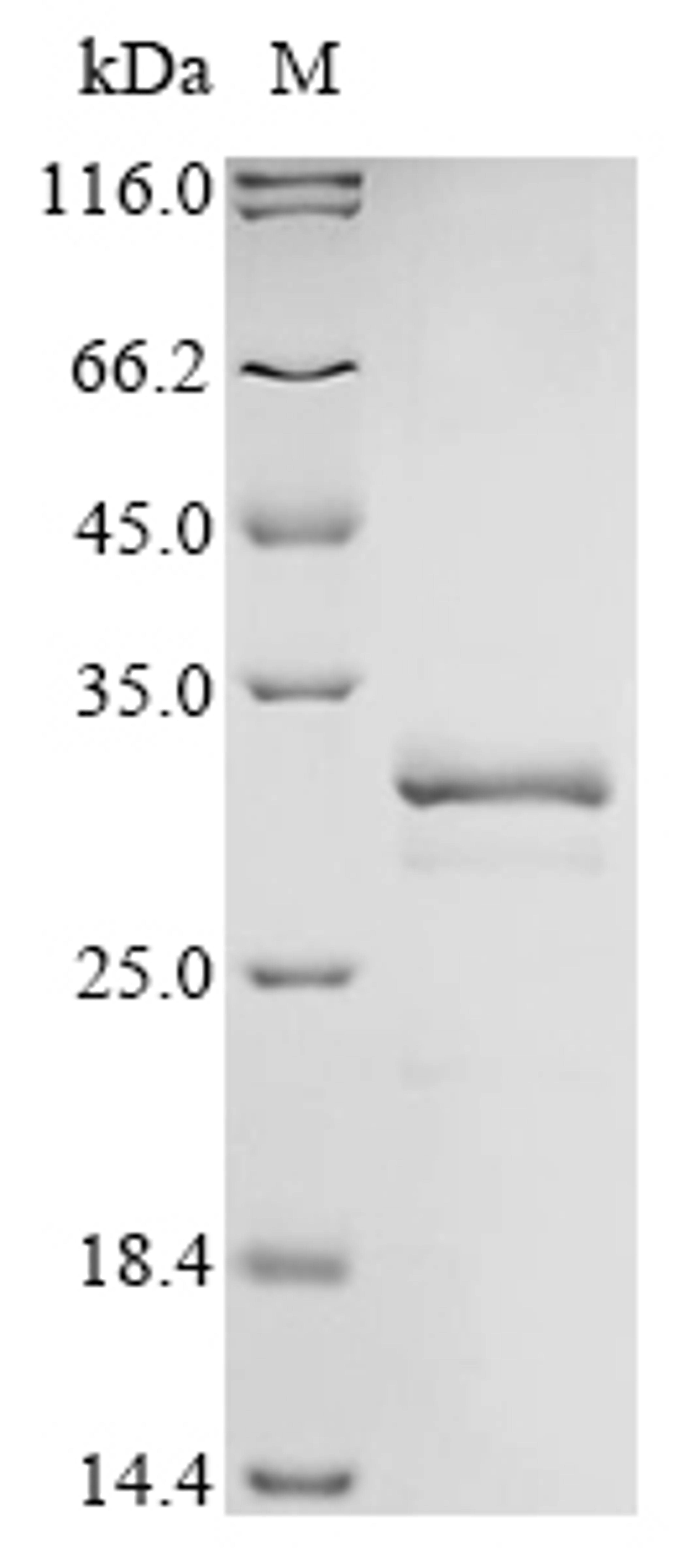 (Tris-Glycine gel) Discontinuous SDS-PAGE (reduced) with 5% enrichment gel and 15% separation gel.