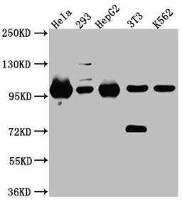 Western Blot. Positive WB detected in: Hela whole cell lysate, 293 whole cell lysate, HepG2 whole cell lysate, NIH/3T3 whole cell lysate, K562 whole cell lysate. All lanes: STAT6 Antibody at 1:1000. Secondary. Goat polyclonal to rabbit IgG at 1/50000 dilution. Predicted band size: 95, 75, 82 kDa. Observed band size: 100 kDa. 