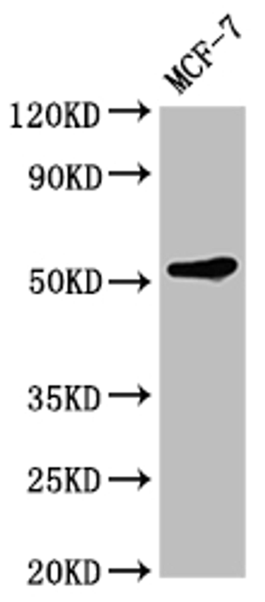 Western Blot. Positive WB detected in: MCF-7 whole cell lysate. All lanes: KMT5C antibody at 1:2000. Secondary. Goat polyclonal to rabbit IgG at 1/50000 dilution. Predicted band size: 53 kDa. Observed band size: 53 kDa. 
