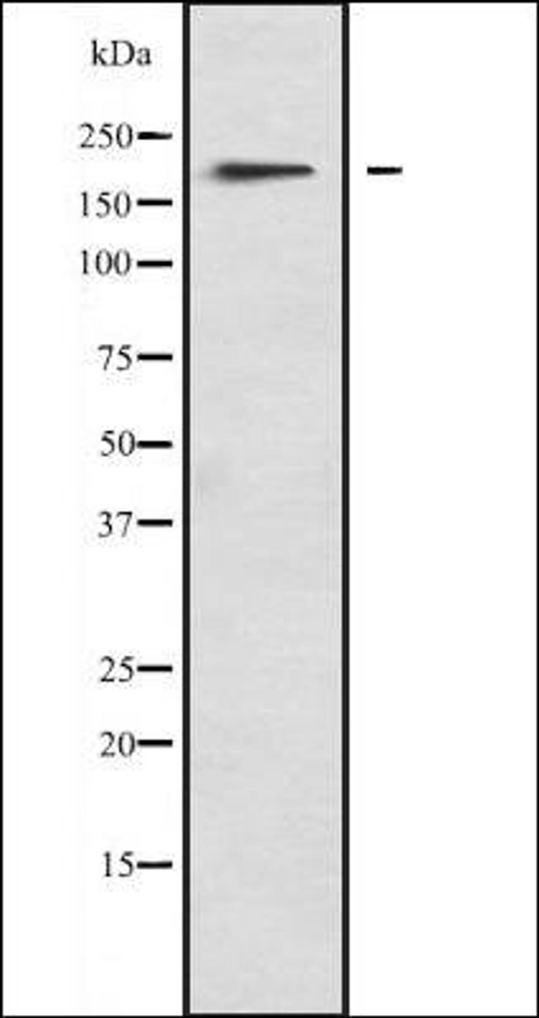 Western blot analysis of A673 lysate using MYO1F antibody