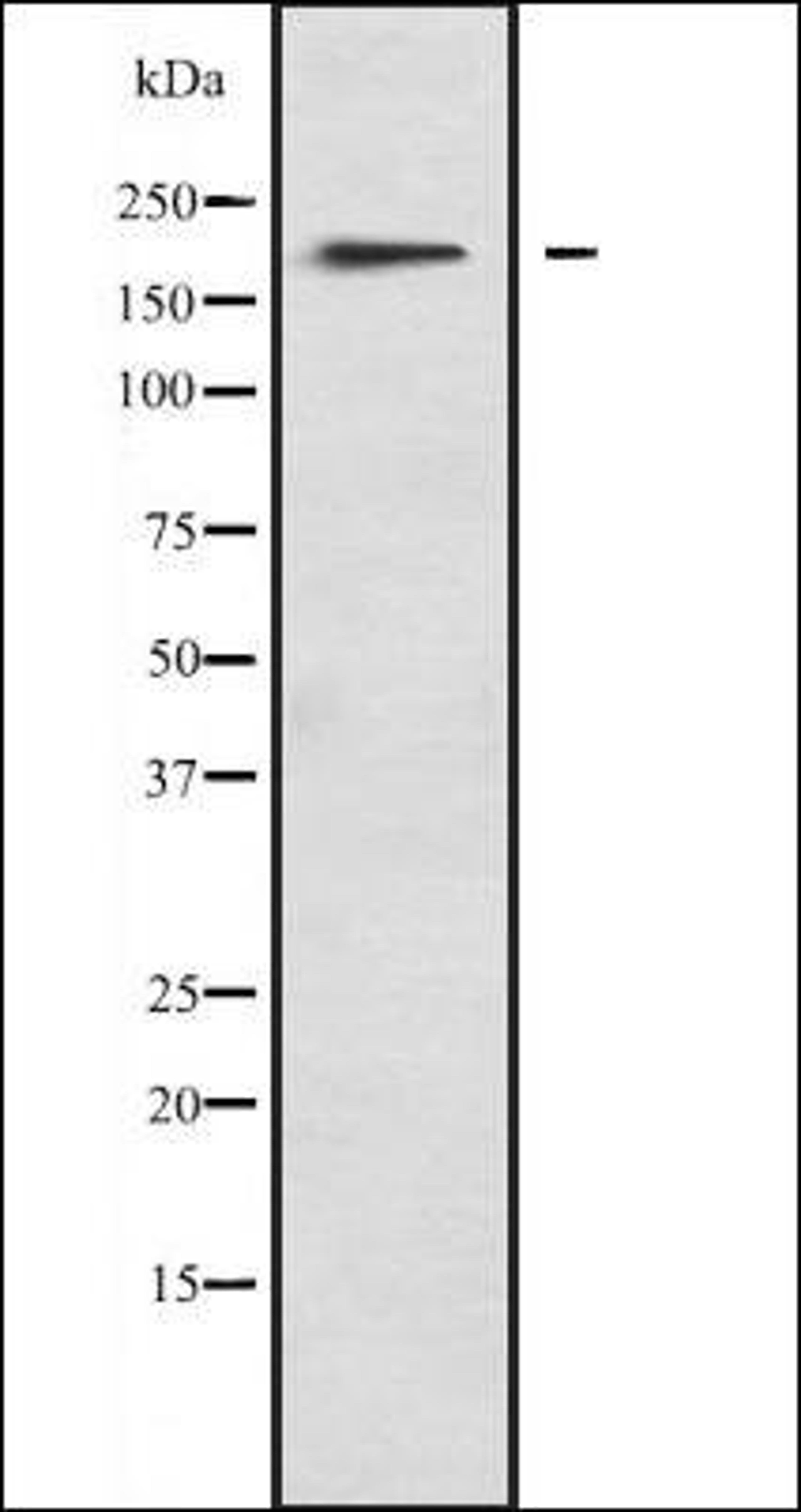 Western blot analysis of A673 lysate using MYO1F antibody