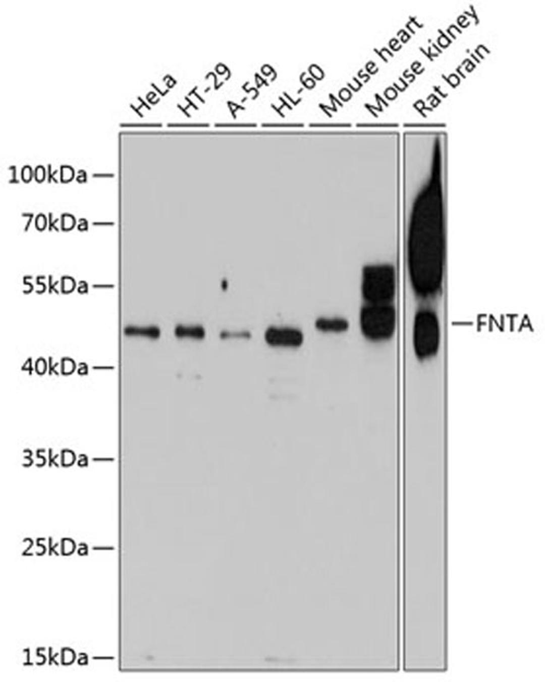 Western blot - FNTA antibody (A8805)