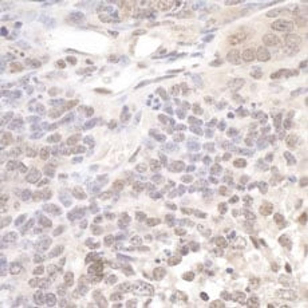 Detection of mouse Pol Lambda by immunohistochemistry.