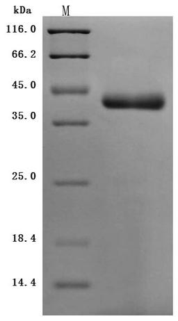 (Tris-Glycine gel) Discontinuous SDS-PAGE (reduced) with 5% enrichment gel and 15% separation gel.