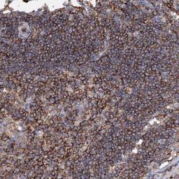 Immunohistochemistry-Paraffin: UBASH3B/STS1/Tula-2 Antibody [NBP2-34053] - Staining of human lymph node shows strong cytoplasmic positivity in germinal and non germinal center cells.