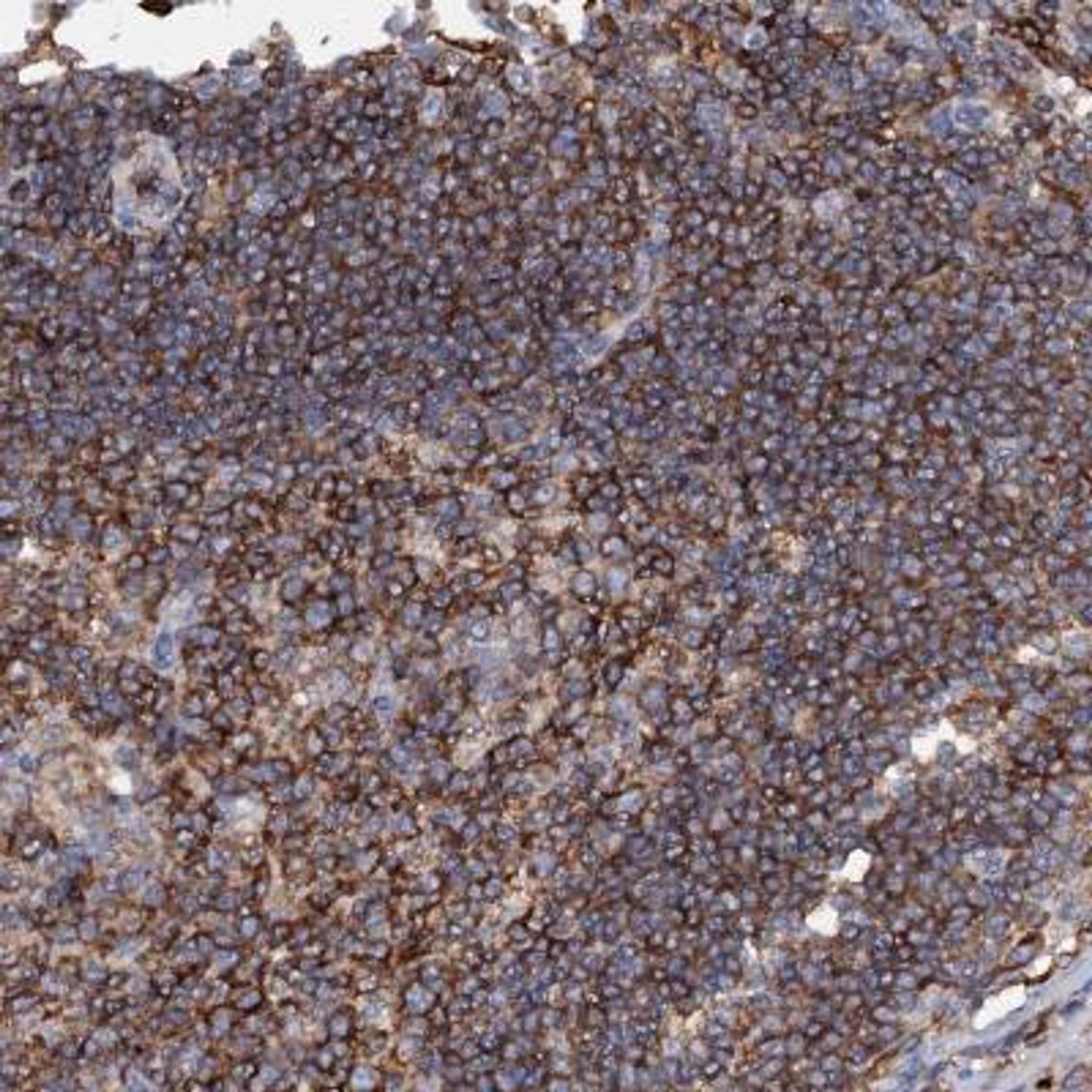 Immunohistochemistry-Paraffin: UBASH3B/STS1/Tula-2 Antibody [NBP2-34053] - Staining of human lymph node shows strong cytoplasmic positivity in germinal and non germinal center cells.