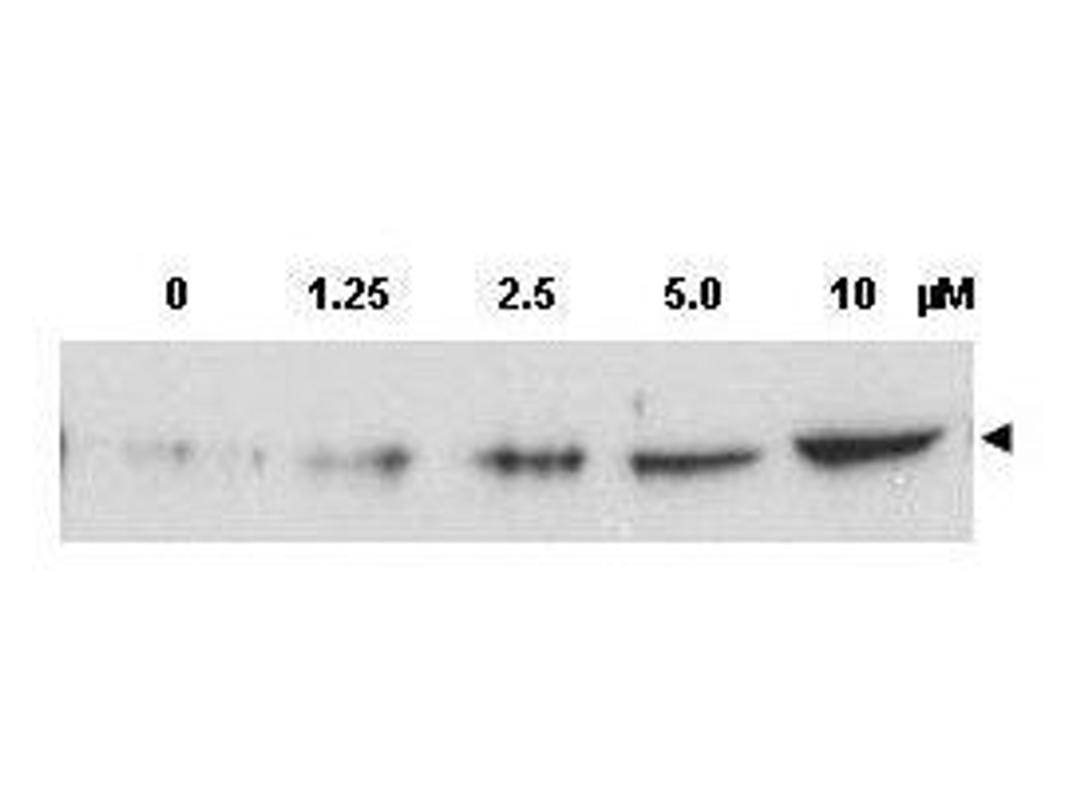 Western blot analysis of MCF-7 whole cell lysates using CHK2 (phospho-T68) antibody