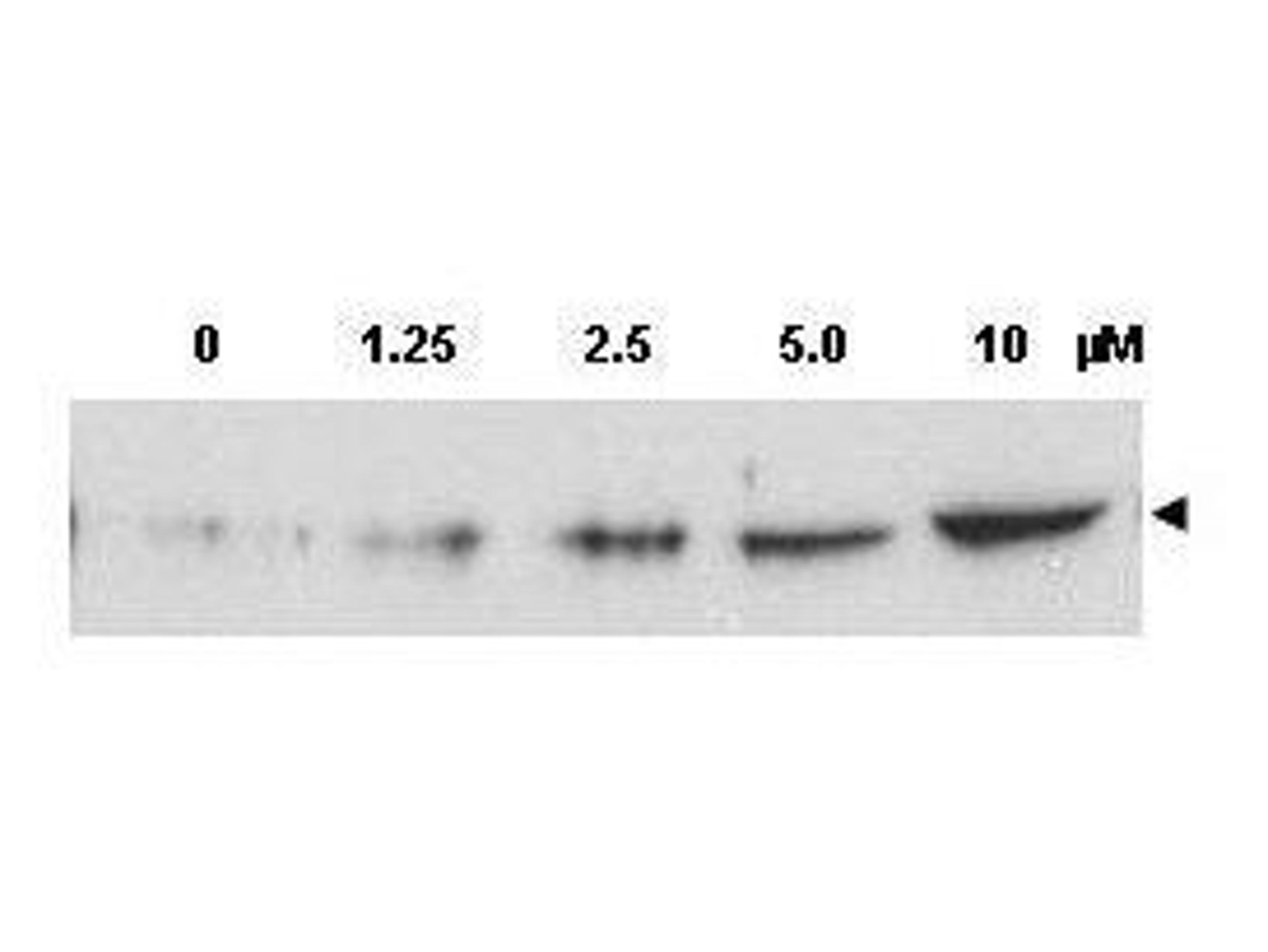 Western blot analysis of MCF-7 whole cell lysates using CHK2 (phospho-T68) antibody