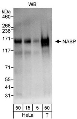 Detection of human NASP by western blot.