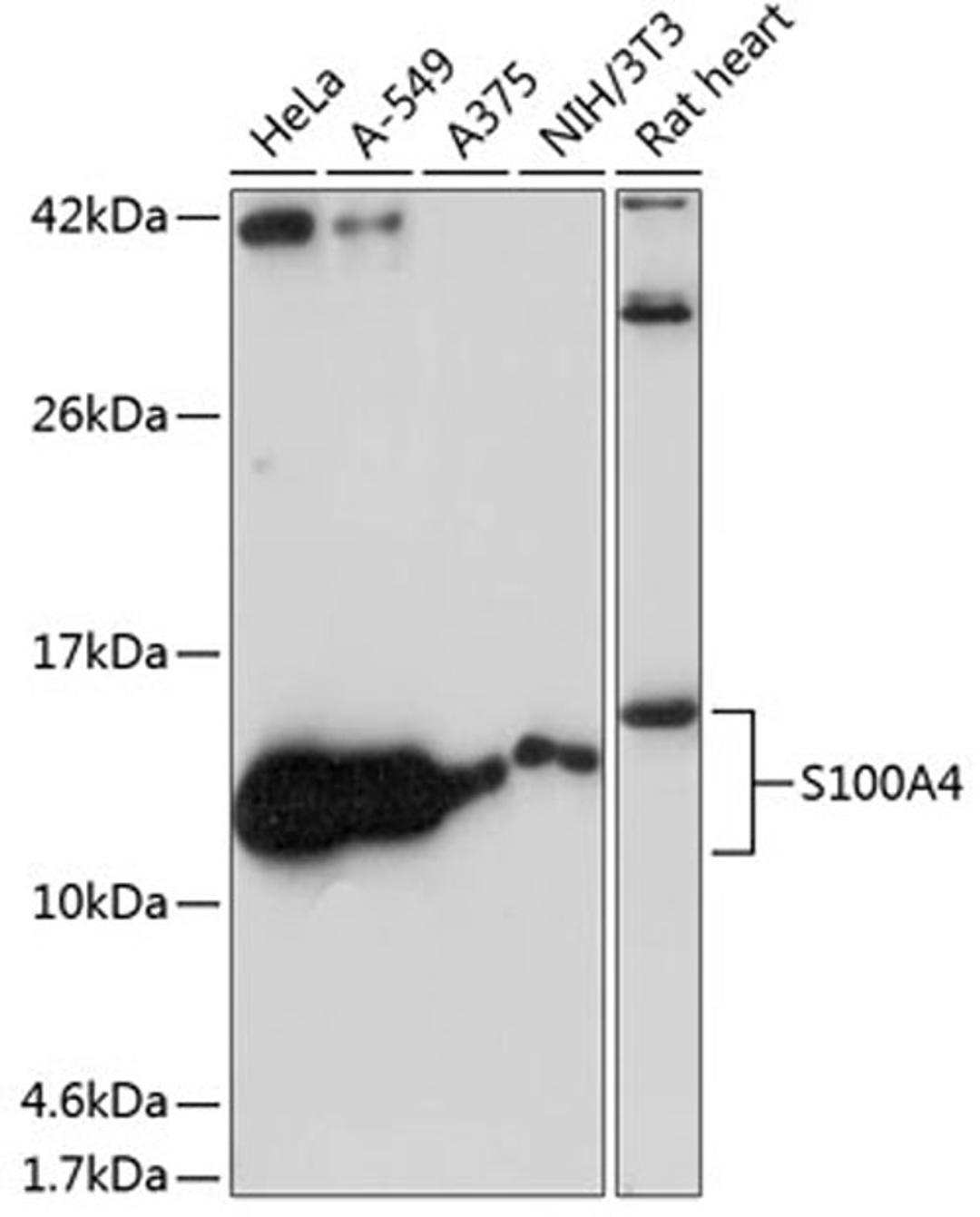 Western blot - FSP1/S100A4 antibody (A19109)