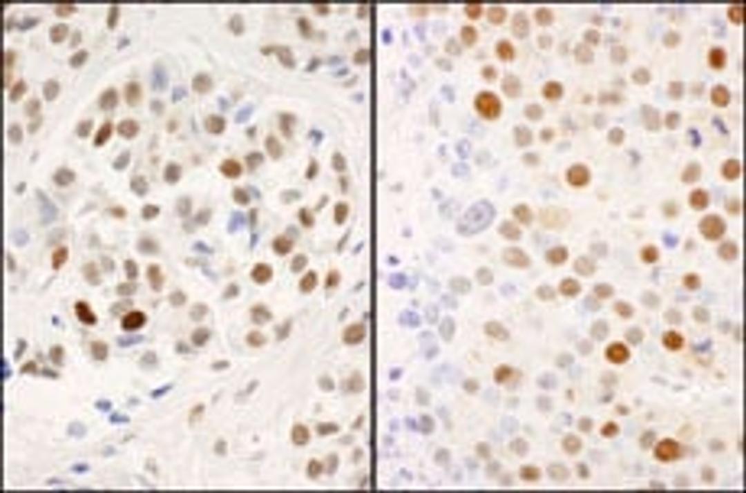 Detection of human and mouse Phospho MCM2 (S53) by immunohistochemistry.