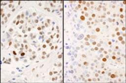 Detection of human and mouse Phospho MCM2 (S53) by immunohistochemistry.