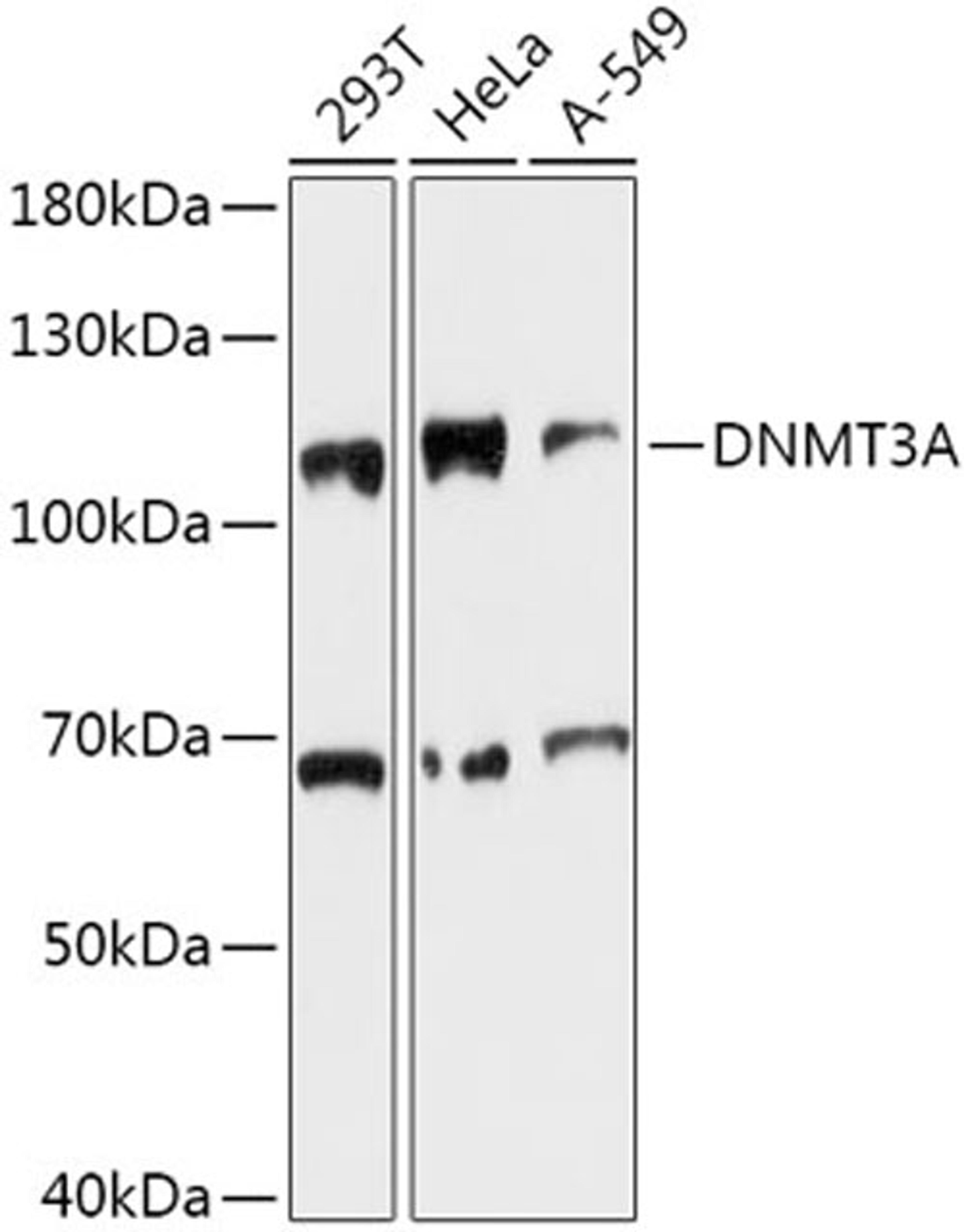 Western blot - DNMT3A antibody (A11791)