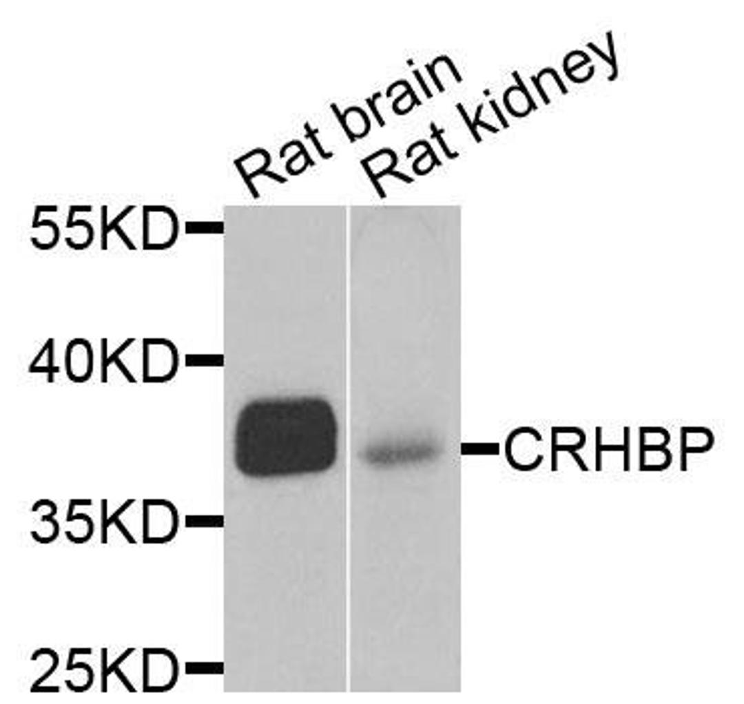 Western blot analysis of extracts of various cells using CRHBP antibody