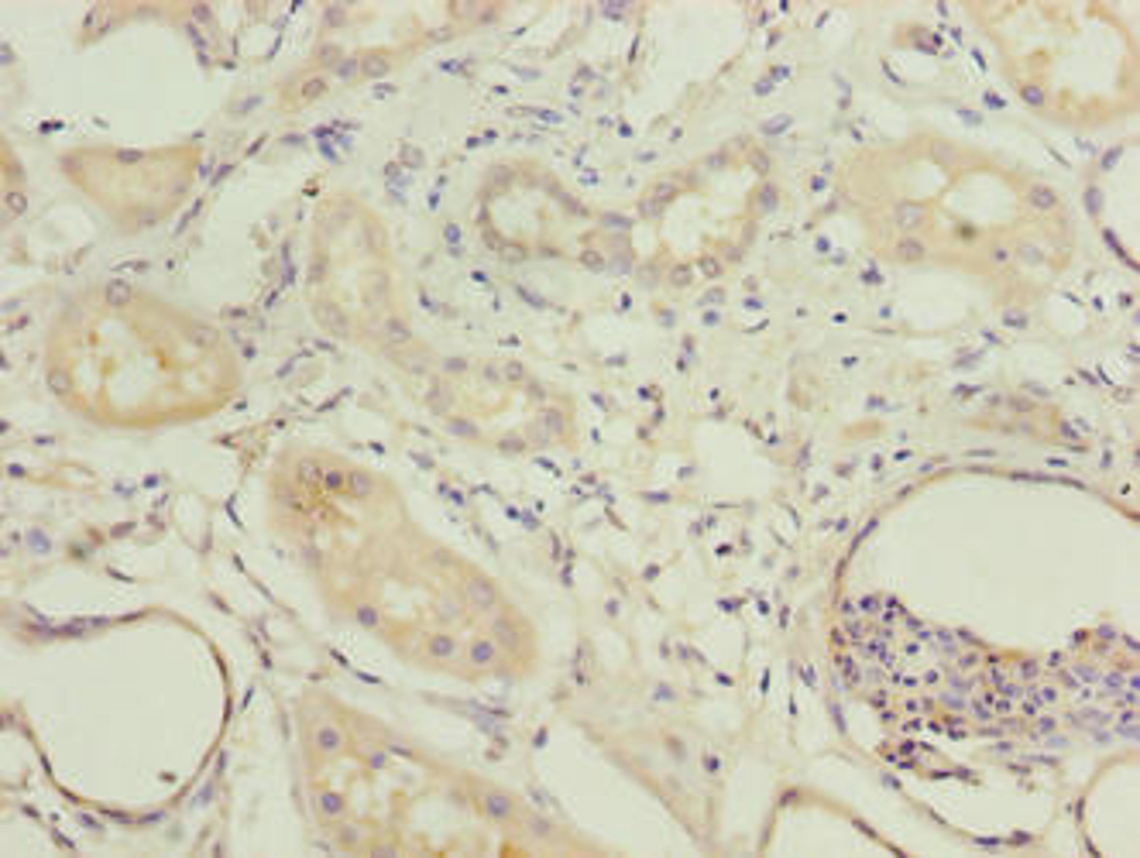 Immunohistochemistry of paraffin-embedded human kidney tissue using CSB-PA706643LA01HU at dilution of 1:100