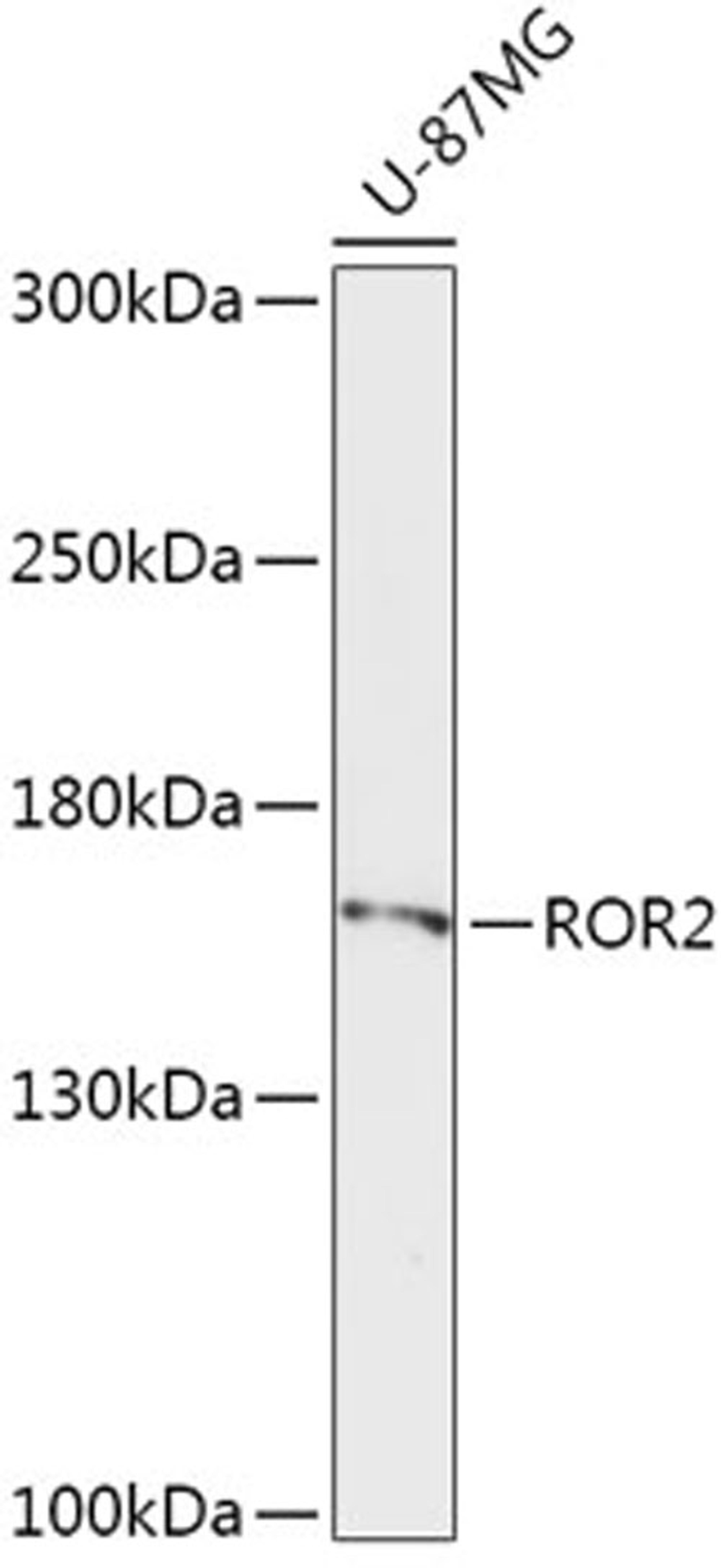 Western blot - ROR2 antibody (A5620)