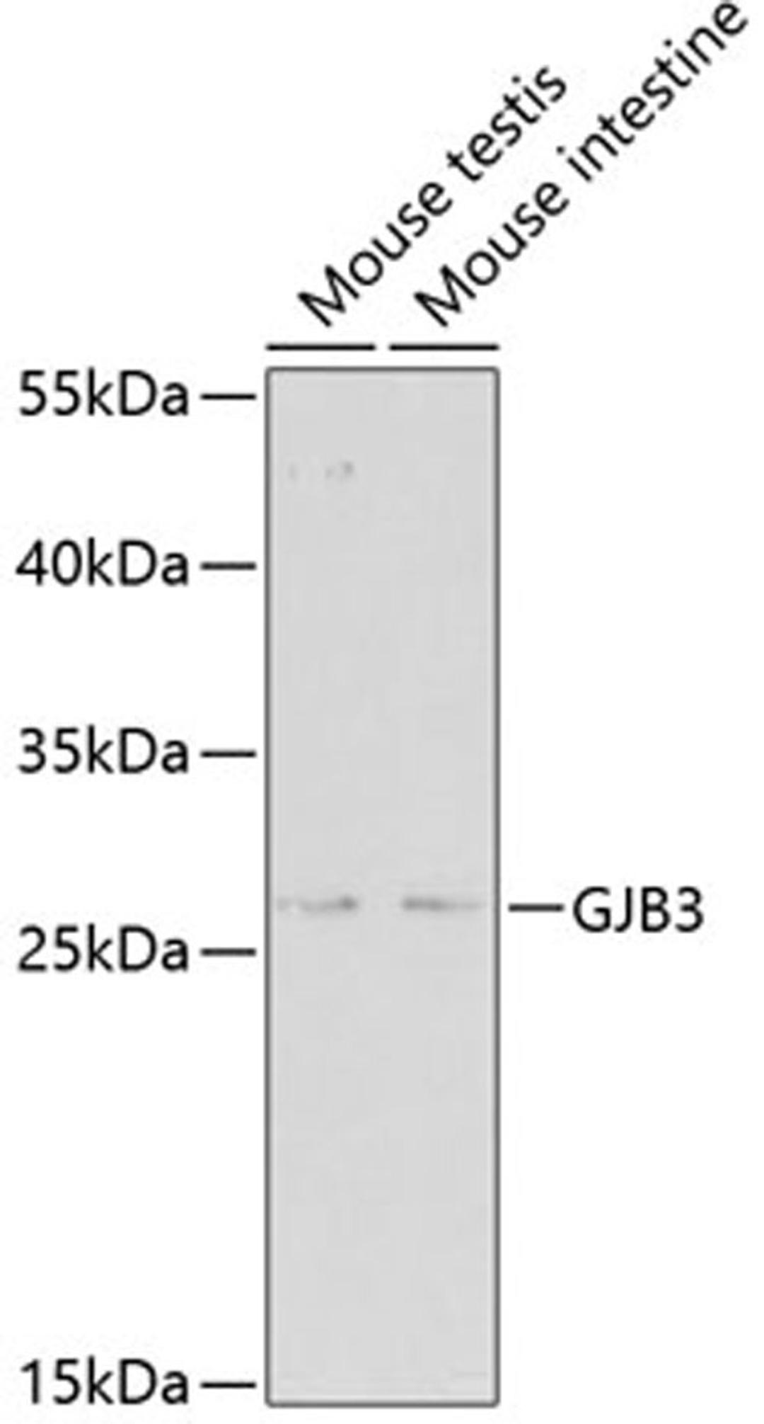 Western blot - GJB3 antibody (A2949)