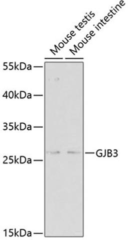 Western blot - GJB3 antibody (A2949)