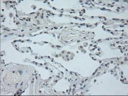 Immunohistochemistry-Paraffin: Oncostatin M Antibody (2B6) [NBP1-47904] Staining of paraffin-embedded lung tissue using anti-Oncostatin M mouse monoclonal antibody.