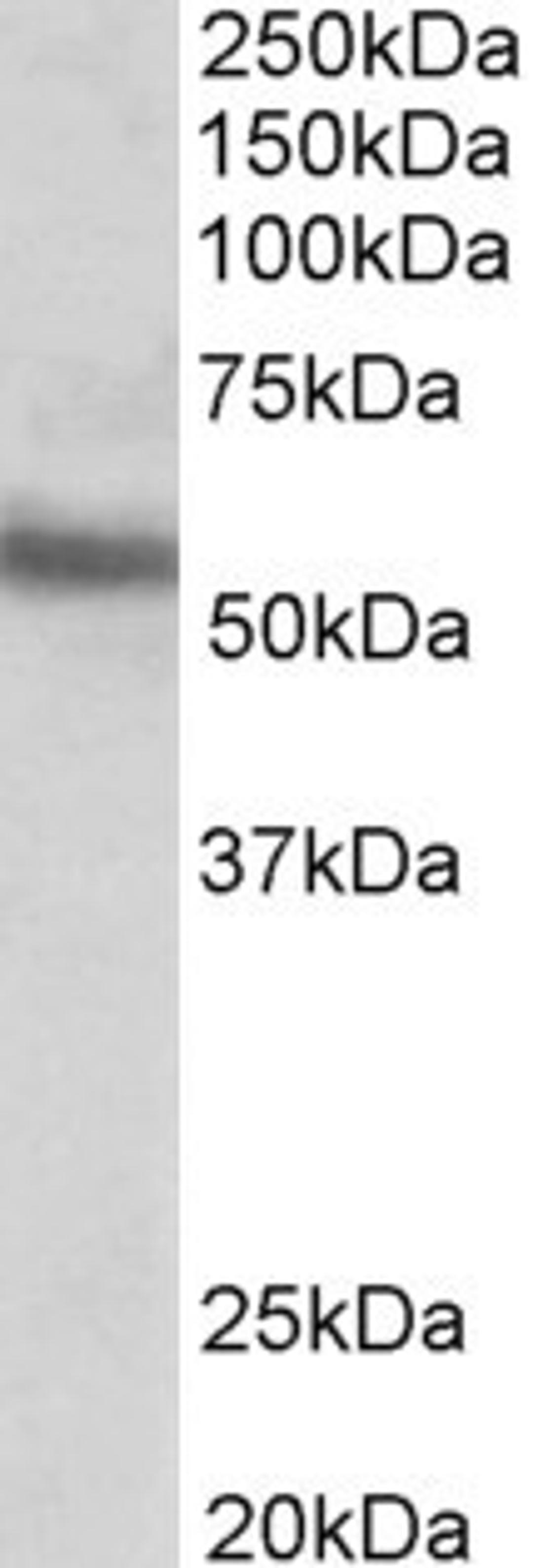 45-549 (0.1ug/ml) staining of MOLT4 lysate (35ug protein in RIPA buffer). Primary incubation was 1 hour. Detected by chemiluminescence.